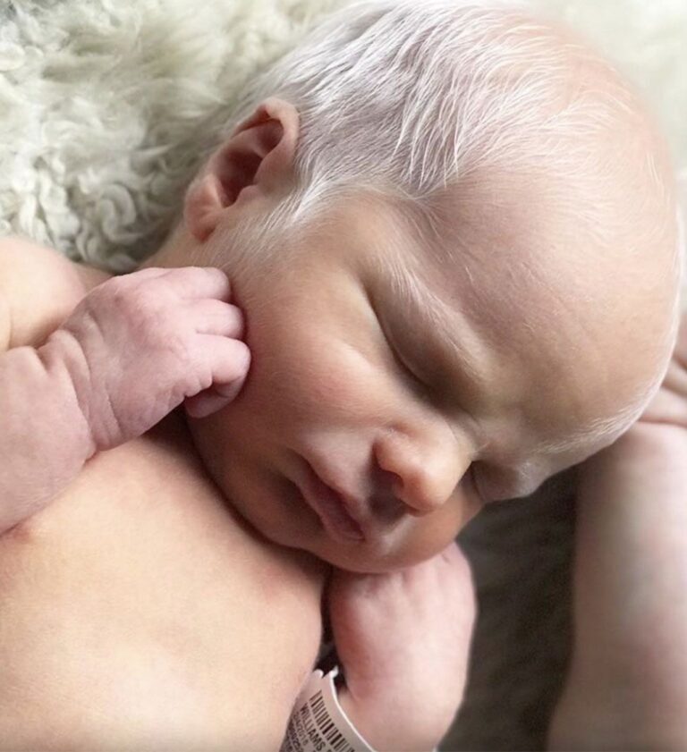 He was mocked online for his looks when he was born. They said “he’s born old”, “and looks like a grandpa.” But wait till you see what he looks like now. Photos in the comments… 👇🏻⁣👇🏻