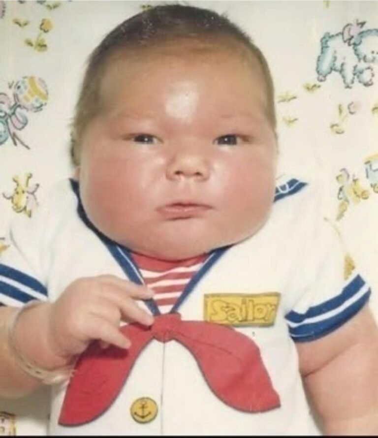 In 1983, a baby boy weighing a whopping 16 lbs was born! At the time, the entire country was shocked by his size, labeling him “The Country’s Biggest Baby” How does he look today? Well, take a seat before you see Check his photos in the comment