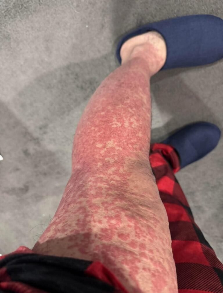 These are the consequences of sleeping with the…See more