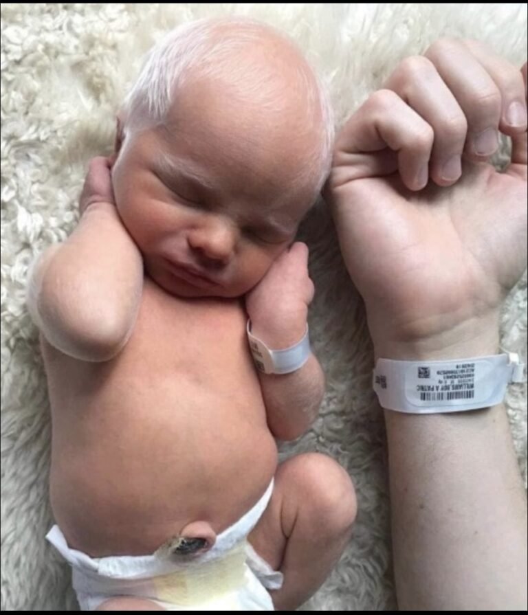 Albino baby mocked for white hair is happy and healthy years later.