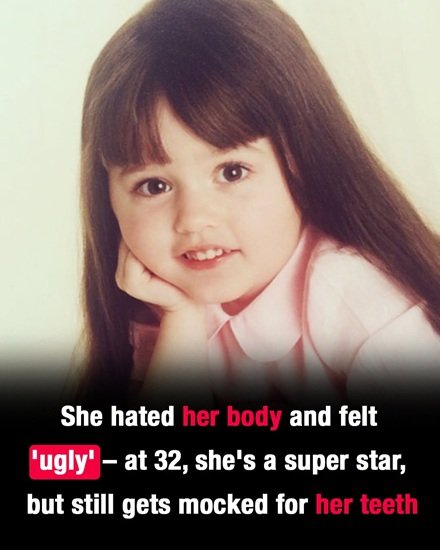 She Once Struggled With Body Image and Felt “Ugly” — Now a Star at 32 Facing Online Mockery For Her Teeth