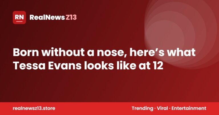 Born without a nose, here’s what Tessa Evans looks like at 12